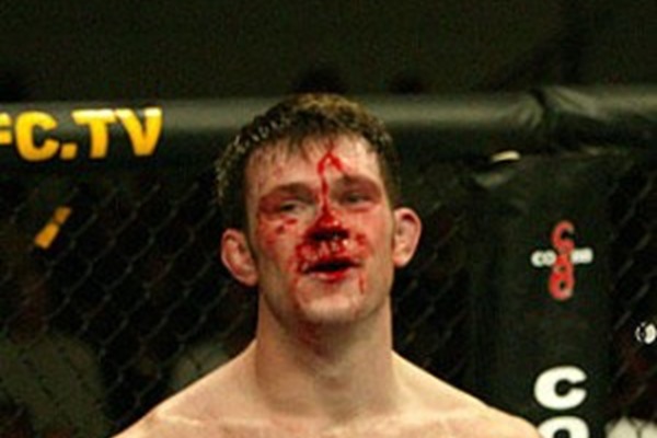 UFC News: Forrest Griffin Admits He Took Xanax Night Before UFC 101 Fight with Anderson Silva